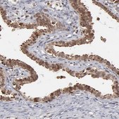 Anti-RGS6 antibody produced in rabbit Prestige Antibodies® Powered by Atlas Antibodies, affinity isolated antibody, buffered aqueous glycerol solution
