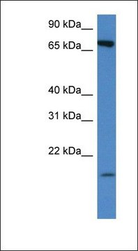 Anti-SLC5A2 antibody produced in rabbit affinity isolated antibody