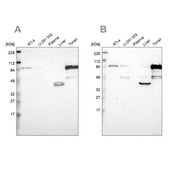 Anti-SH3KBP1 antibody produced in rabbit Ab2, Prestige Antibodies® Powered by Atlas Antibodies, affinity isolated antibody, buffered aqueous glycerol solution
