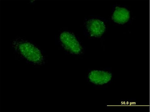 Anti-GRHL2 antibody produced in mouse purified immunoglobulin, buffered aqueous solution