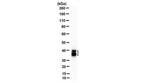 Anti-SET (I2PP2A) Antibody, N-term Antibody, clone 10E7 clone 10E7, from mouse