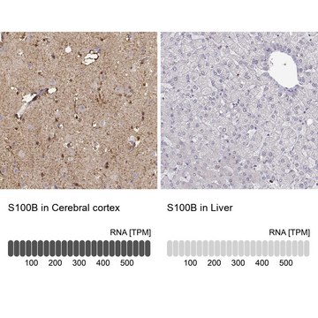 抗-S100B 兔抗 affinity isolated antibody, buffered aqueous glycerol solution