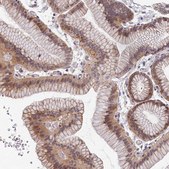 Anti-TMEM116 antibody produced in rabbit affinity isolated antibody, buffered aqueous glycerol solution