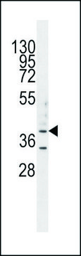 ANTI-B3GALT5 (N-TERM) antibody produced in rabbit IgG fraction of antiserum, buffered aqueous solution