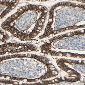 Anti-RNF149 antibody produced in rabbit Prestige Antibodies® Powered by Atlas Antibodies, affinity isolated antibody, buffered aqueous glycerol solution