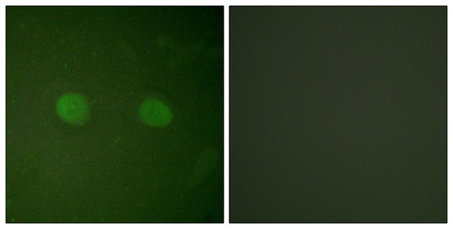 Anti-PPAR-&#945; antibody produced in rabbit affinity isolated antibody