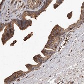 Anti-COQ8B antibody produced in rabbit Prestige Antibodies® Powered by Atlas Antibodies, affinity isolated antibody, buffered aqueous glycerol solution, ab1