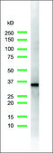 Anti-Cyclin D1 antibody, Rabbit monoclonal recombinant, expressed in proprietary host, clone SP4, tissue culture supernatant