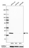 Anti-PPIB antibody produced in rabbit Prestige Antibodies® Powered by Atlas Antibodies, affinity isolated antibody, buffered aqueous glycerol solution