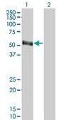 ANTI-PAX8 antibody produced in mouse clone 1A6, purified immunoglobulin, buffered aqueous solution