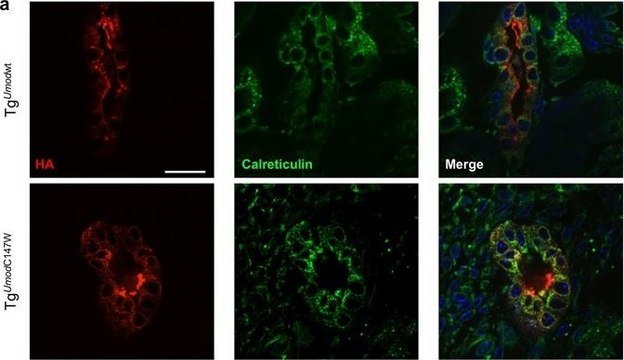 Anti-Calreticulin antibody produced in rabbit IgG fraction of antiserum, buffered aqueous solution