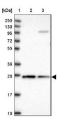 Anti-CYB5R2 antibody produced in rabbit Prestige Antibodies® Powered by Atlas Antibodies, affinity isolated antibody, buffered aqueous glycerol solution