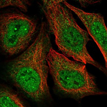 Anti-MAGEA11 antibody produced in rabbit Prestige Antibodies&#174; Powered by Atlas Antibodies, affinity isolated antibody