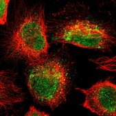 Anti-ALKBH3 antibody produced in rabbit Prestige Antibodies® Powered by Atlas Antibodies, affinity isolated antibody, buffered aqueous glycerol solution