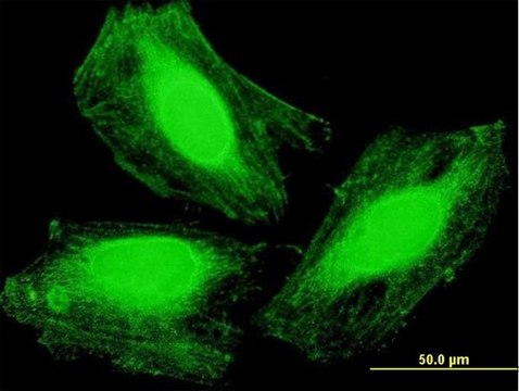 Anti-ARMC1 antibody produced in mouse purified immunoglobulin, buffered aqueous solution