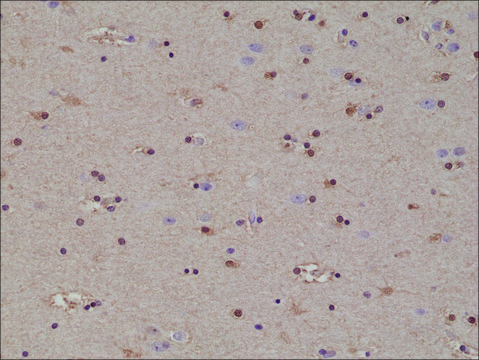 Anti-S100-beta antibody, Rabbit Monoclonal recombinant, expressed in HEK 293 cells, clone RM304, purified immunoglobulin