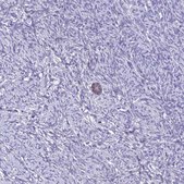 Anti-ZMIZ1 antibody produced in rabbit Prestige Antibodies® Powered by Atlas Antibodies, affinity isolated antibody, buffered aqueous glycerol solution