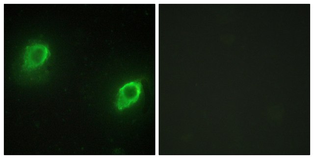 Anti-AKAP5 antibody produced in rabbit affinity isolated antibody