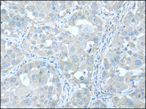 Anti-UBE2Q2 affinity isolated antibody