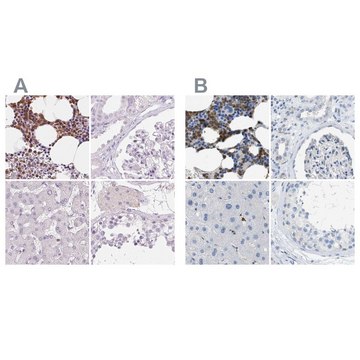 Anti-SERPINB1 antibody produced in rabbit Prestige Antibodies&#174; Powered by Atlas Antibodies, affinity isolated antibody, buffered aqueous glycerol solution