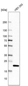 Anti-RPL26 antibody produced in rabbit Prestige Antibodies® Powered by Atlas Antibodies, affinity isolated antibody, buffered aqueous glycerol solution
