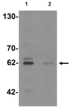 Anti-KCNK13 Antibody from rabbit, purified by affinity chromatography