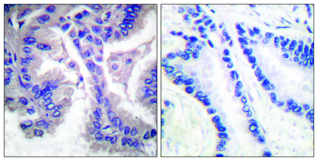 Anti-CASP6 (Cleaved-Asp162) antibody produced in rabbit affinity isolated antibody