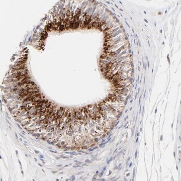 Anti-PDE4B antibody produced in rabbit Prestige Antibodies&#174; Powered by Atlas Antibodies, affinity isolated antibody, buffered aqueous glycerol solution