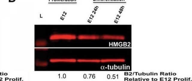 Anti-Tubulin Antibody, beta III isoform, CT, clone TU-20 (Similar to TUJ1) ascites fluid, clone TU-20 (Similar to TUJ1), Chemicon&#174;