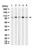 Anti-FKHR/FOXO1 Antibody, clone 1D21 ZooMAb® Rabbit Monoclonal recombinant, expressed in HEK 293 cells