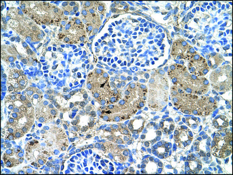 Anti-GLS2 IgG fraction of antiserum