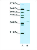 Anti-GRHL3 (AB2) antibody produced in rabbit affinity isolated antibody