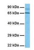 Anti-WT1 affinity isolated antibody