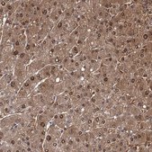Anti-GSTO1 antibody produced in rabbit Prestige Antibodies® Powered by Atlas Antibodies, affinity isolated antibody, buffered aqueous glycerol solution