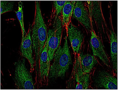 Monoclonal Anti-SOS antibody produced in mouse clone SOS-01