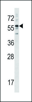 ANTI-KRT3 (CENTER) antibody produced in rabbit IgG fraction of antiserum, buffered aqueous solution