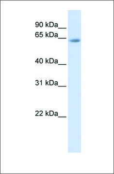 Anti-TCF7L2 (ab2) antibody produced in rabbit affinity isolated antibody