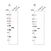Anti-CAPG antibody produced in rabbit Prestige Antibodies® Powered by Atlas Antibodies, affinity isolated antibody, buffered aqueous glycerol solution