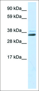 抗 SFRP1 兔抗 IgG fraction of antiserum