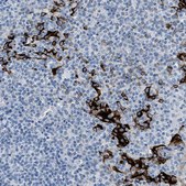 Anti-FDCSP antibody produced in rabbit Prestige Antibodies® Powered by Atlas Antibodies, affinity isolated antibody, buffered aqueous glycerol solution