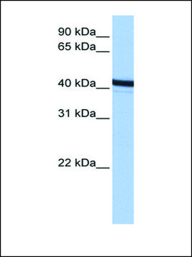 Anti-ACTR1B antibody produced in rabbit affinity isolated antibody