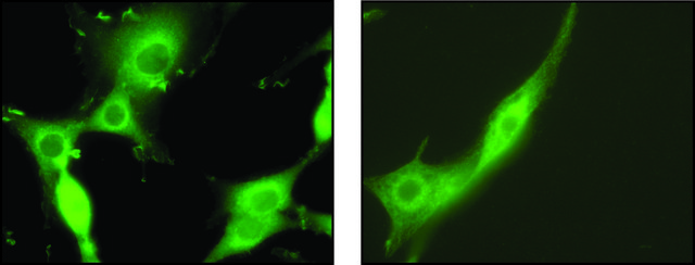 Anti-Syntaxin 7 antibody produced in rabbit IgG fraction of antiserum, buffered aqueous solution