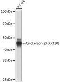 Anti-Cytokeratin 20 (KRT20) Antibody, clone 8C6A3, Rabbit Monoclonal