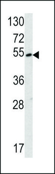 ANTI-SUV4-20H2 (CENTER) antibody produced in rabbit purified immunoglobulin, buffered aqueous solution