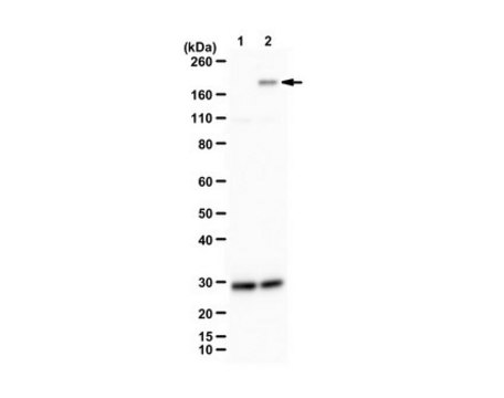 Anti-phospho DCC (Tyr1418) serum, from rabbit