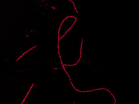 Rhodamine B labeled Ramoplanin For fluorescent microbial imaging