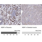 Anti-IKBIP antibody produced in rabbit affinity isolated antibody