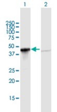 Anti-GIPC1 antibody produced in mouse purified immunoglobulin, buffered aqueous solution