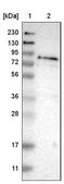 Anti-FRRS1 antibody produced in rabbit Prestige Antibodies® Powered by Atlas Antibodies, affinity isolated antibody, buffered aqueous glycerol solution