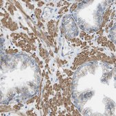 Anti-MYH11 antibody produced in rabbit Prestige Antibodies® Powered by Atlas Antibodies, affinity isolated antibody, buffered aqueous glycerol solution